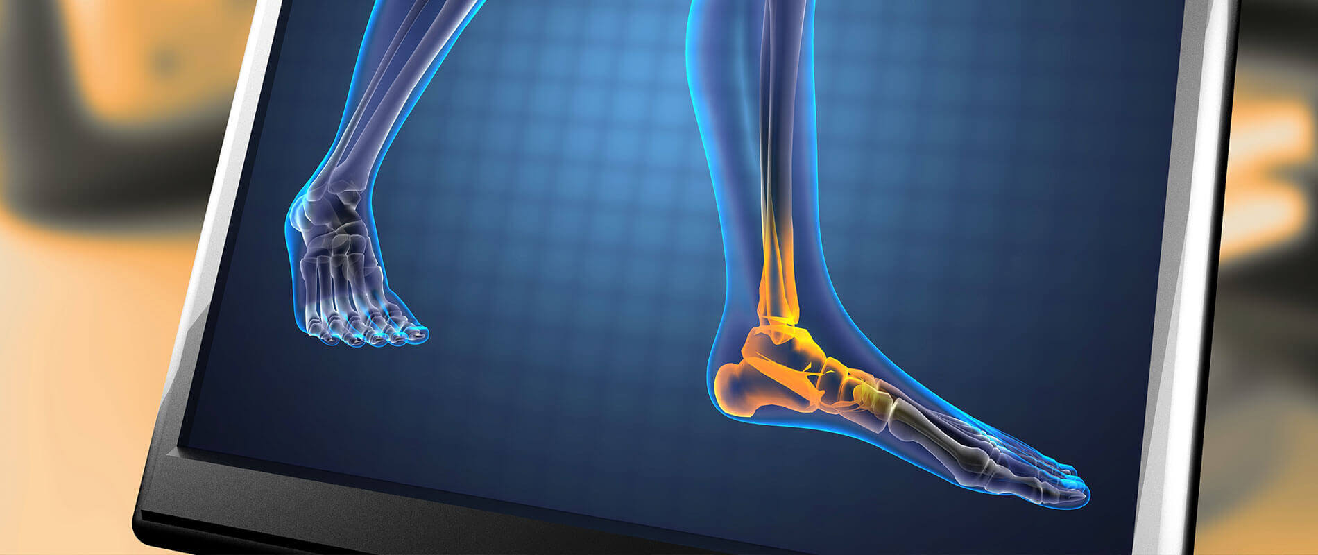 Emil Babayev, DPM Podiatrist, Foot Doctor Brooklyn, NY 11229 and 11230