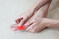 What You Should Know About Gout