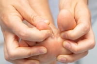 Understanding Athlete’s Foot and Relief Tips